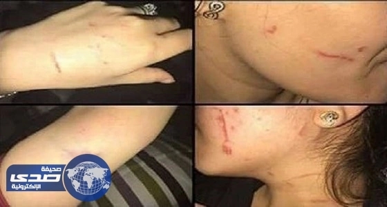 مدني جدة يكشف تفاصيل جديدة في حريق المحلات التجارية بحي البلد