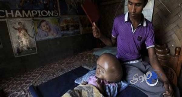 فريق جراحي بمستشفى الأنصار بالمدينة ينقذ مريضة من سرطان المستقيم