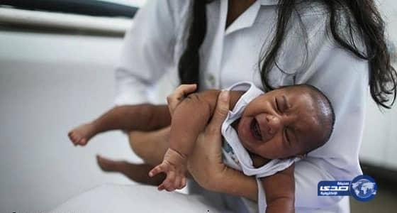 أول رضيع مصاب بصغر حجم الرأس بسبب فيروس «زيكا» بنيويورك