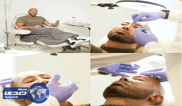 بالفيديو.. وديع النجار " خطيب اليسا " يحقن وجهه بالبوتوكس