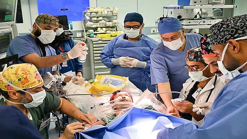 بدء عملية فصل التوأم الملتصق السعودي.. صور
