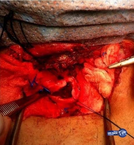 شاهد.. سائق دباب يسرق جوال مواطن في حي العمارية ويفر مسرعا