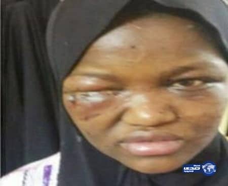 بلاغ من الجيران ينقذ خادمة إثيوبية من تعذيب كفيلها بمكة (صور)