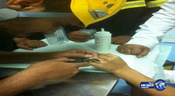 مستشفى شقراء يستعين بالمدني لتخليص شاب من خاتمه