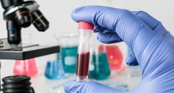 تطوير عقار لعلاج فيروس الإيدز قريبا