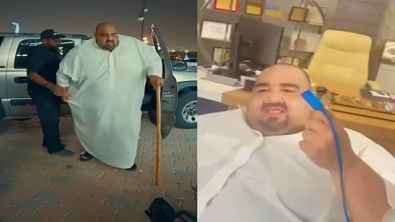 شاب سعودي يجري جراحة سمنة ناجحة بعدما بلغ وزنه 330 كغم.. فيديو