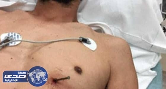 ⁠⁠⁠⁠⁠" قرار صعب " أنقذ حياة أمريكي استقر مسمار في قلبه