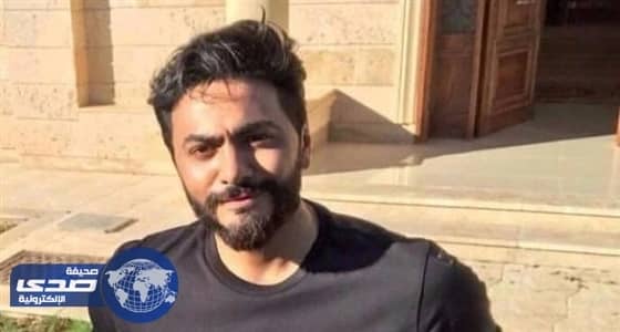 إصابة تامر حسني تجبره على إلغاء أعماله الفنية