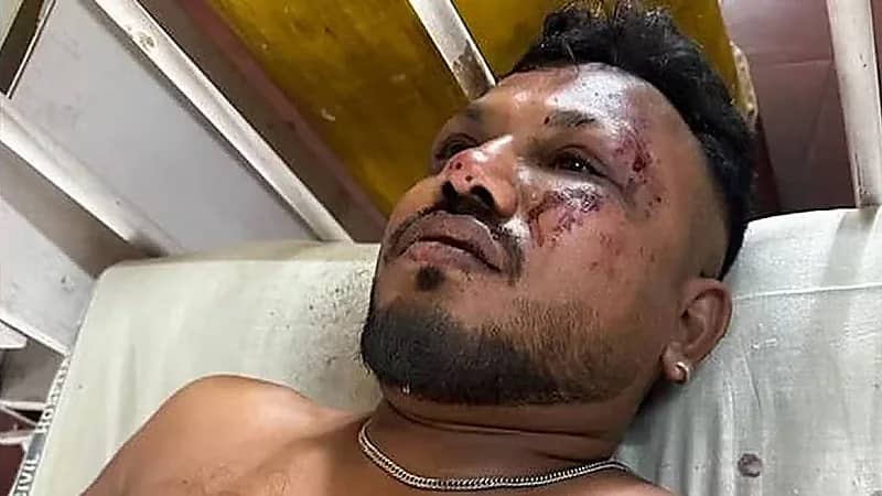 العثور على ناجي وحيد من الطائرة التي تحطمت وعلى متنها 242 شخص.. فيديو