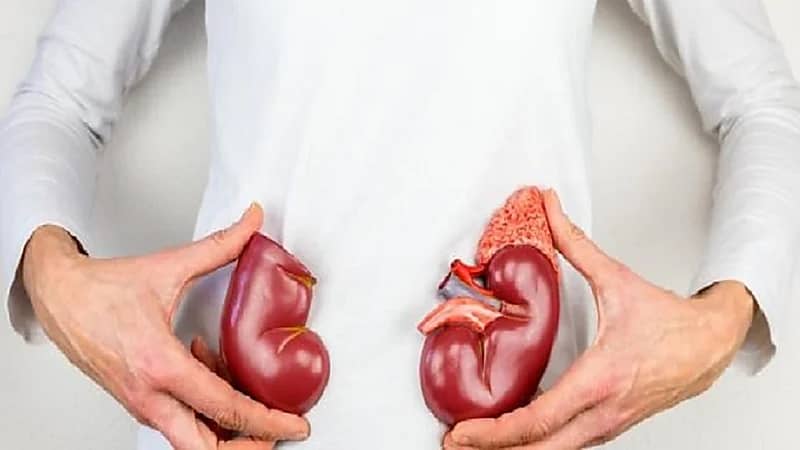 استشاري يوضح كيفية حماية الكليتين من التلف