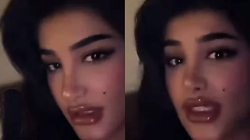 ميلان السبيعي: سويت تجميل بفلوسي والله يرزق كل محروم.. فيديو