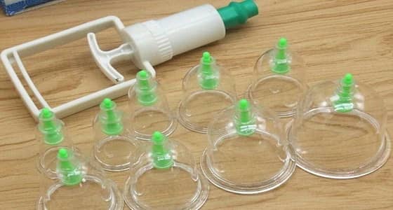 " الوطني للطب البديل " يوجه بإجراء الحجامة في منشآت مرخصة