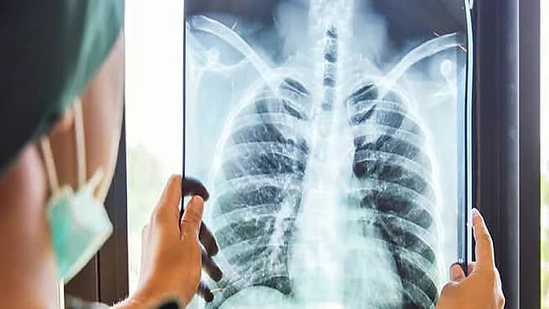 علماء يحذرون من إهمال مرض خطير