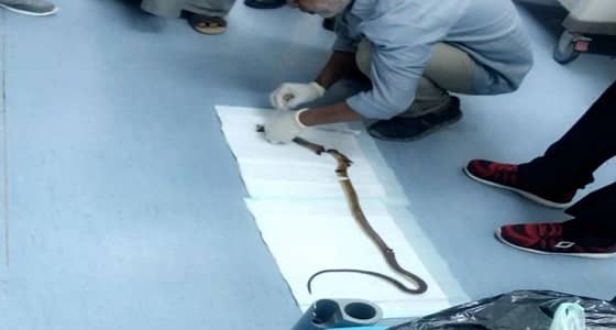 وفاة طفلتين بـ " لدغة ثعبان " أثناء زيارتهما بيت جدهما بقلوة