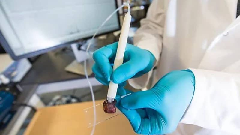 "الصحة" تكشف مدى تأثير أخذ عينة من الثدي على انتشار السرطان