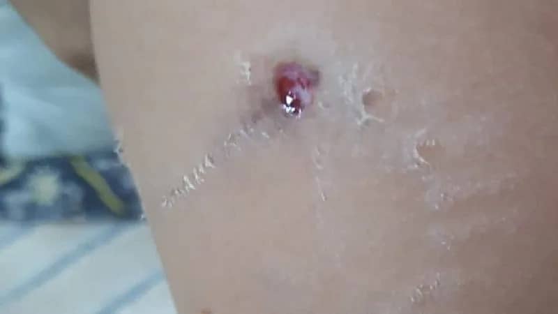 رئيس بلدية تيماء يطمئن على طفل هاجمته كلاب ضالة