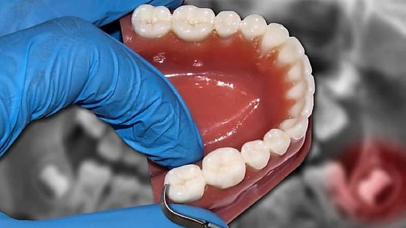 القبض على طبيبة خدرت زوجها وخلعت أسنانه