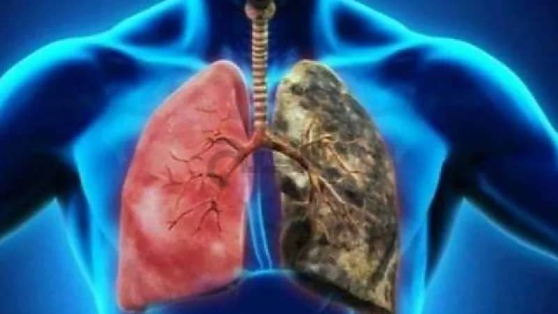 إزالة سموم الرئة في 8 خطوات