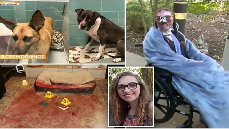 شاهد.. كلبان يمزقا وجه فتاة بالكامل