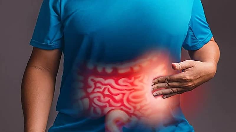 طييب يحذر من وصفة متداولة لعلاج القولون العصبي