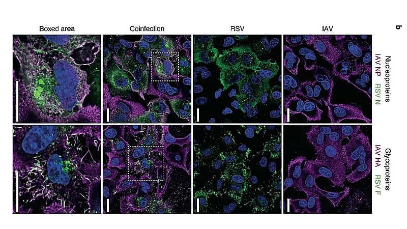 "استشاري": الباحثون عرضوا أدلة دامغة تؤكد أن عدوى فيروس الانفلونزا و RSV تولد جزيئات هجينه