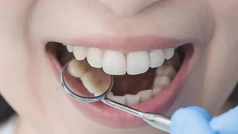مشروب صباحي شائع يضعف أسنانك