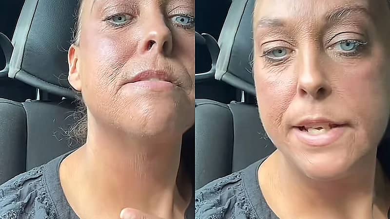 منتج تجميلي شهير يشوه وجه امرأة وتظهر بعمر الشيخوخة .. فيديو