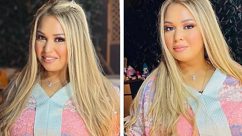 ويزو ترد على شائعات التكميم وتكشف سر خسارة وزنها .. صور