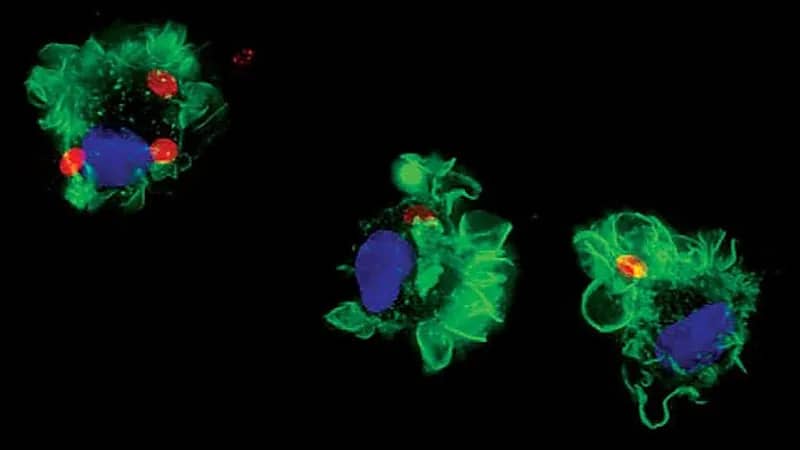 الكشف عن عدوى جديدة تهدد سكان العالم
