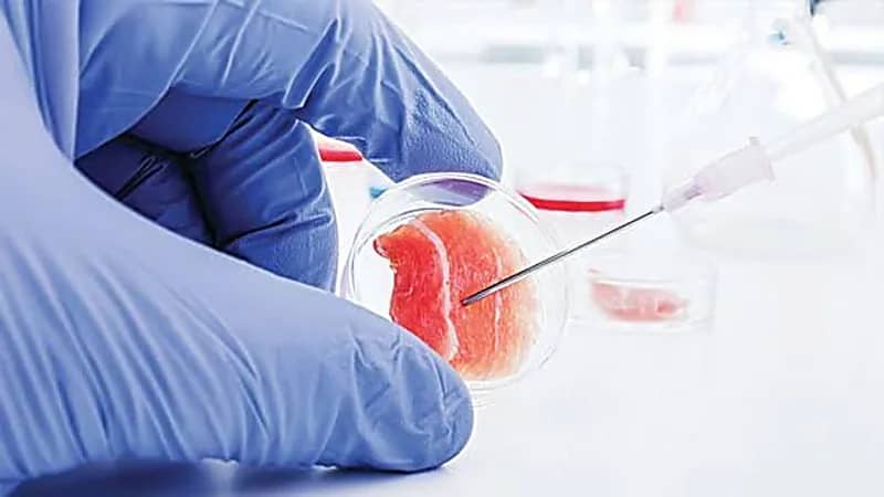 «الصحة»: ‏لم يثبت علميًا أي علاقة بين الخلايا الجذعية والشفاء من مرض السكري