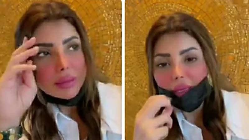 شاهد.. إلهام الفضالة تظهر بوجه متورم ومنتفخ لهذا السبب