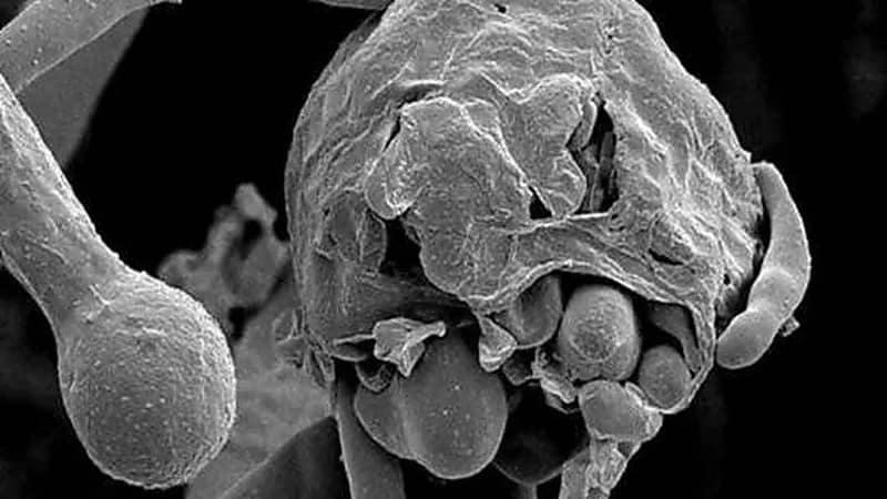 وفاة مصابة مصرية بالفطر الأسود رغم عدم إصابتها بـ«كورونا» 