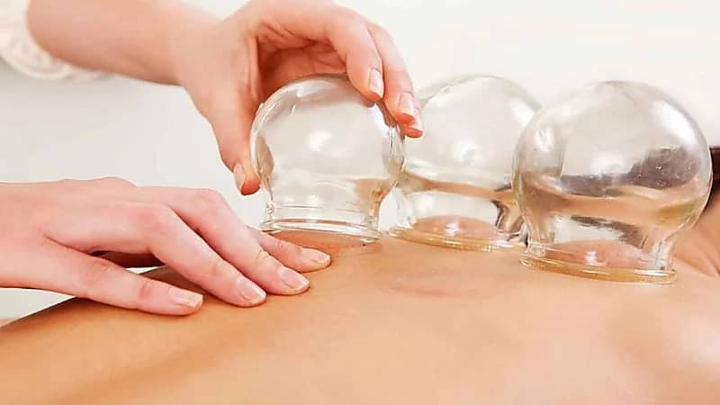 بالفيديو.. إخصائية: الحجامة قد تسبب الوفاة