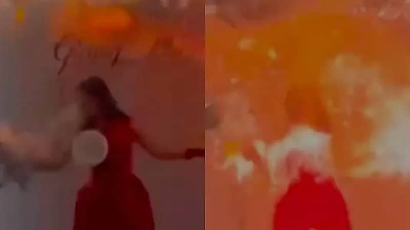 إصابة مؤثرة بحروق خطيرة بسبب انفجار بالون .. فيديو