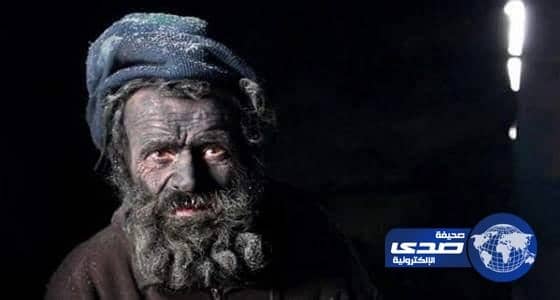 بالفيديو ..وفاة ستيني صاحب لقب أقذر رجل في أوروبا