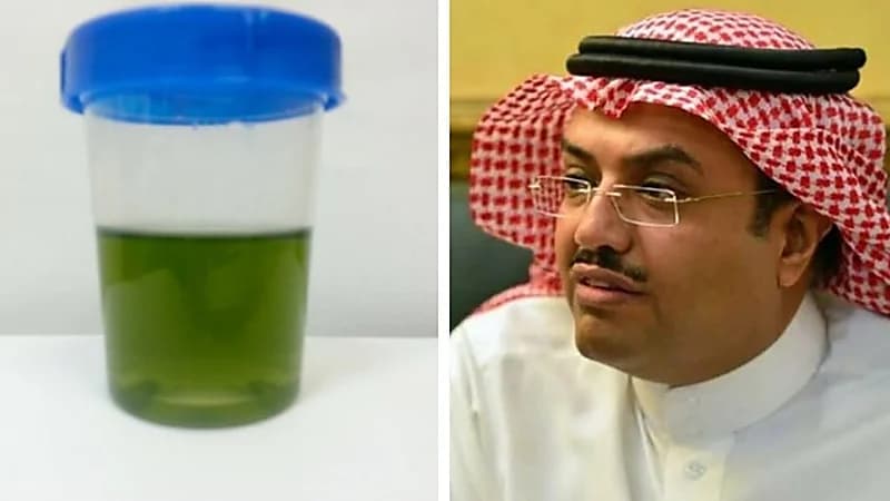 النمر يكشف عن سبب تغير لون البول إلى الأخضر