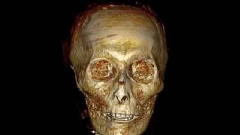 شاهد.. أسرار مذهلة تم اكتشافها بمومياء فرعون مصر منذ 3500‪ عام