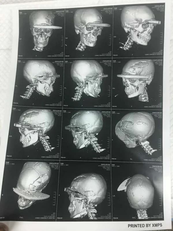 شاهد.. الحديثي يكشف عن طرق وآليات مواجهة ظاهرة التسول في شهر رمضان