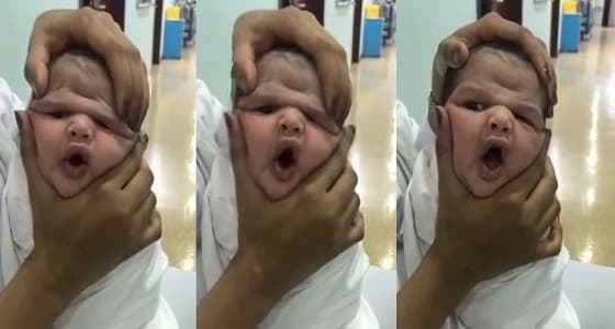 إحالة الممرضات العابثات بطفل الطائف للنيابة العامة