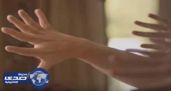 بالفيديو.. تشوه خلقي يتحول لكنز في أيدي عائله برازيلية