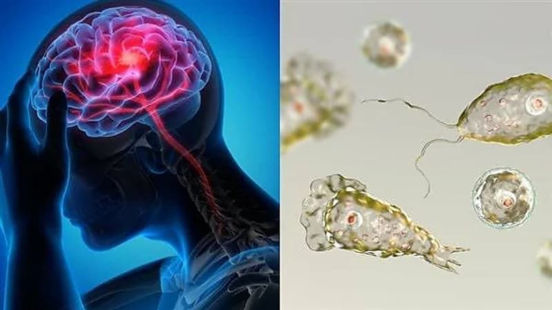 آكلات الدماغ تنهي حياة باكستاني