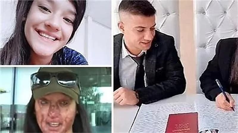 شاب يشوه وجه حبيبته لتتزوج منه