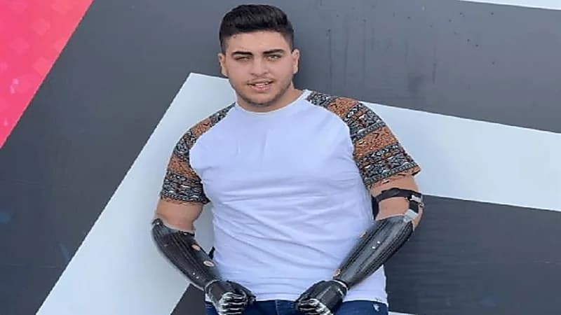 بالفيديو.. أطراف صناعية تساعد «فتى حادثة الزرقاء» الأردني في العودة لحياته الطبيعية