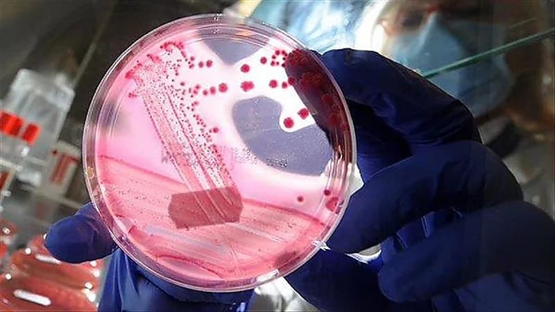 العراق..تحذير من انتشار وباء الحمى النزفية