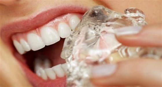 طرق علاج آلام " الضرس " منزليًا