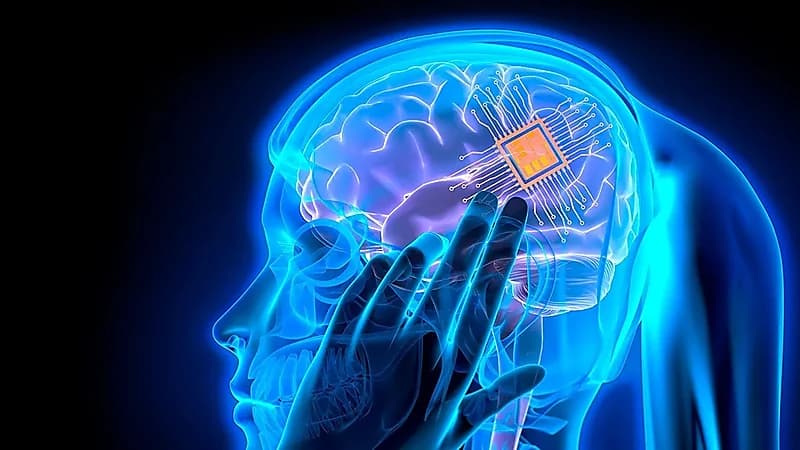 طبيب: زراعة شرائح إلكترونية داخل الدماغ أثبتت فاعليتها في 5 أمراض