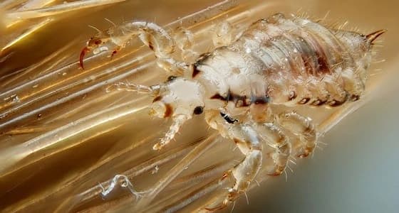 بعد رواج تجارته عبر مواقع التواصل.. استخدام " القمل " لإطالة الشعر