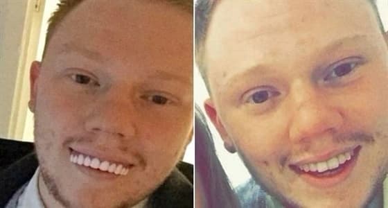 شاب اشترى طقم أسنان للحصول على ابتسامة جذابة فتحول لوجه مضحك