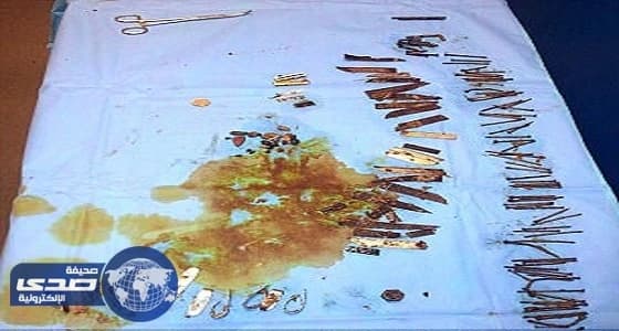 بالصور.. إخراج 100 قطعة معدنية من بطن مريض