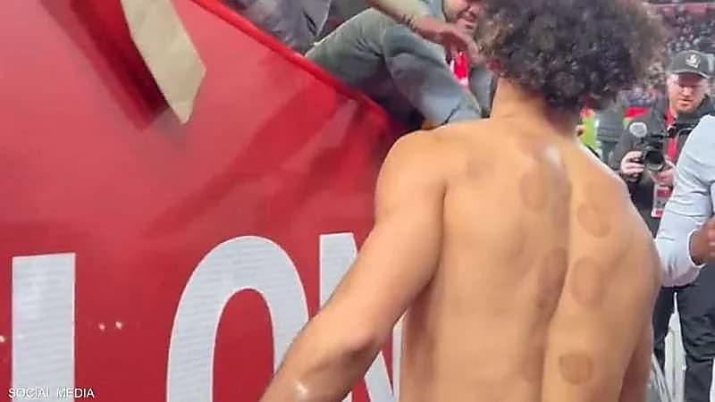 شاهد.. آثار الحجامة على ظهر محمد صلاح تلفت الأنظار